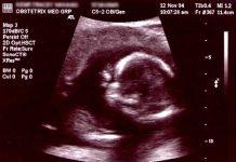 Liberian Catholic Bishops Break Ranks with Interfaith Council Over Public Health Bill Obsteric ultrasonography of a healthy female at 8weeks and 5days (By Doctor - Transferred from specialist.org en.women’s specialist to Commons., Public Domain Wikimedia)
